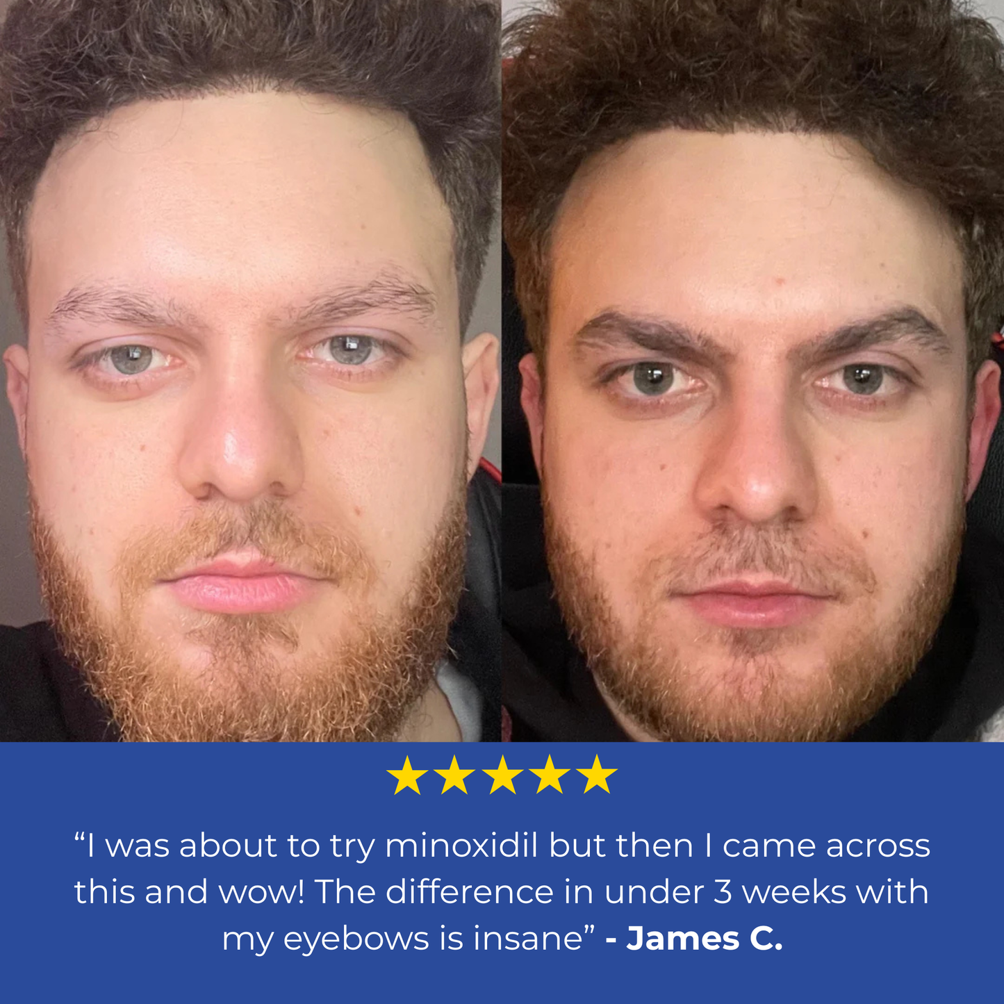 Beard & Brow Roller