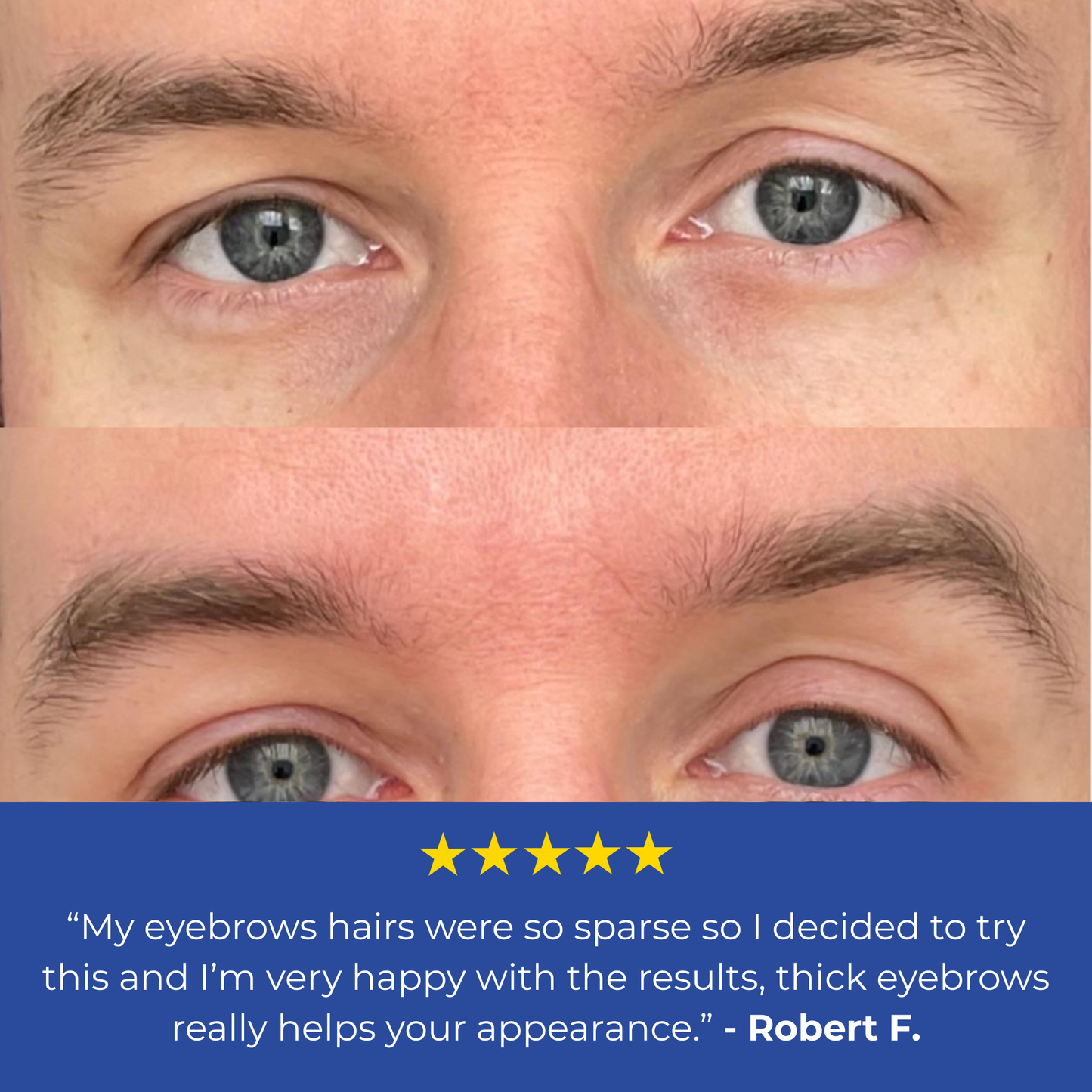 Beard & Brow Roller
